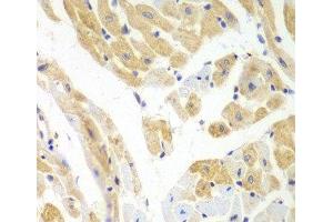 Immunohistochemistry of paraffin-embedded Mouse heart using PCBP2 Polyclonal Antibody at dilution of 1:100 (40x lens). (PCBP2 Antikörper)