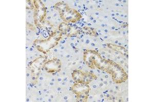 Immunohistochemistry of paraffin-embedded rat kidney using MTERFD3 antibody. (MTERFD3 Antikörper  (AA 1-250))