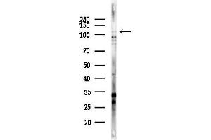 anti-Kinase Suppressor of Ras 1 (KSR1) (pSer392), (pSer40) antibody