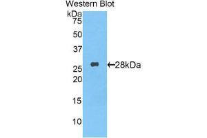 Western Blotting (WB) image for anti-Tumor Necrosis Factor (Ligand) Superfamily, Member 13b (TNFSF13B) (AA 68-283) antibody (ABIN1174925) (BAFF Antikörper  (AA 68-283))