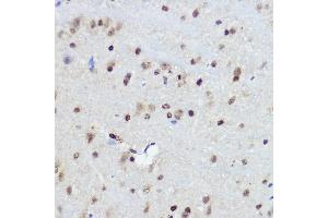 Immunohistochemistry of paraffin-embedded Mouse brain using FANCC antibody (ABIN3022593, ABIN3022594, ABIN3022595 and ABIN6218931) at dilution of 1:100 (40x lens). (FANCC Antikörper  (AA 319-558))
