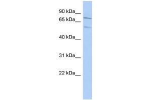WB Suggested Anti-ZNF395 Antibody Titration: 0. (ZNF395 Antikörper  (Middle Region))