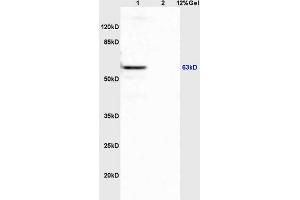 Lane 1: mouse spleen lysates Lane 2: mouse brain lysates probed with Anti APBA3/Mint3/X11 gamma Polyclonal Antibody, Unconjugated (ABIN1385696) at 1:200 in 4 °C. (APBA3 Antikörper  (AA 241-340))
