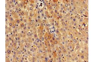 Immunohistochemistry of paraffin-embedded human liver tissue using ABIN7170645 at dilution of 1:100 (SPRED1 Antikörper  (AA 123-311))