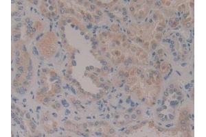 DAB staining on IHC-P; Samples: Human Kidney Tissue (CENPF Antikörper  (AA 436-637))