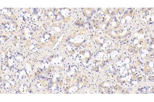 Detection of SIRT3 in Human Stomach Tissue using Monoclonal Antibody to Sirtuin 3 (SIRT3) (SIRT3 Antikörper  (AA 126-399))