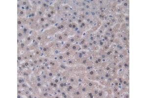 Used in DAB staining on fromalin fixed paraffin- embedded liver tissue (IL-22 Antikörper  (AA 34-179))