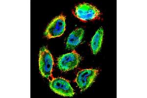 Confocal immunofluorescent analysis of Phospho-P53-S9 Antibody (ABIN1881624 and ABIN2850450) with  cell followed by Alexa Fluor 488-conjugated goat anti-rabbit lgG (green). (p53 Antikörper  (pSer9))