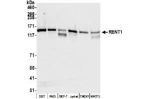 Western Blotting (WB) image for anti-UPF1 Regulator of Nonsense Transcripts Homolog (UPF1) (C-Term) antibody (ABIN7449907)
