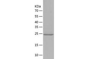 DNMT3L Protein (AA 160-387) (His tag)