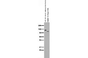 Immunoblot on adult rat brain membranes in comparison with commercial anti-Striatin antibody. (STRN4 Antikörper  (AA 42-354))