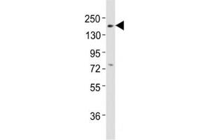 Western blot testing of Erbb3 antibody at 1:2000 dilution + mouse lung lysate