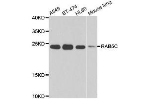 Western blot analysis of extracts of various cell lines, using RAB5C antibody. (Rab5c Antikörper  (AA 1-216))