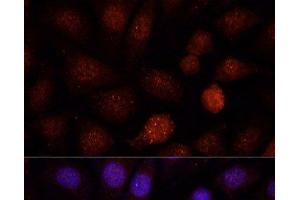 Immunofluorescence analysis of L-929 cells using PCGF1 Polyclonal Antibody at dilution of 1:100. (PCGF1 Antikörper)