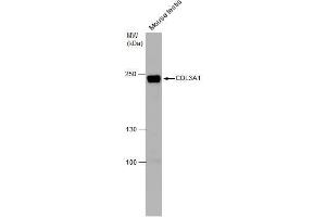 WB Image COL3A1 antibody [C2C3], C-term detects COL3A1 protein by western blot analysis.