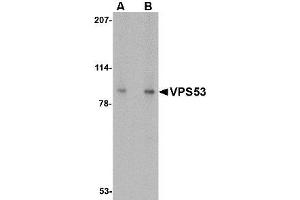 Image no. 1 for anti-Vacuolar Protein Sorting 53 Homolog (VPS53) (C-Term) antibody (ABIN1492163) (VPS53 Antikörper  (C-Term))