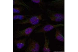 Image no. 3 for anti-Nuclear Factor-kB p65 (NFkBP65) (Ser276) antibody (ABIN197110)