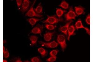 ABIN6273990 staining HepG2 by IF/ICC. (ALAS1 Antikörper  (Internal Region))
