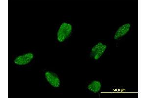 Immunofluorescence of monoclonal antibody to ASCL1 on HeLa cell. (ASCL1 Antikörper  (AA 137-236))