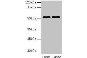 Western blot All lanes: SLC30A6 antibody at 6 μg/mL Lane 1: A549 whole cell lysate Lane 2: U251 whole cell lysate Secondary Goat polyclonal to rabbit IgG at 1/10000 dilution Predicted band size: 52, 56, 48, 49 kDa Observed band size: 52 kDa (SLC3A6 (AA 246-461) Antikörper)