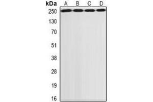 Western blot analysis of GCN2 expression in SKOV3 (A), HepG2 (B), MCF7 (C), rat lung (D) whole cell lysates. (GCN2 Antikörper)