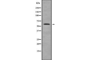 Western blot analysis of MAGE2 using COLO205 whole cell lysates (MAGEE2 Antikörper  (Internal Region))