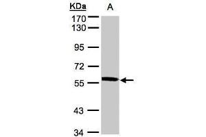 WB Image Sample(30 ug whole cell lysate) A:A431, 7. (XPNPEP3 Antikörper)