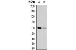 Western blot analysis of CLIP3 expression in human brain (A), A549 (B) whole cell lysates.