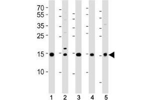 Western blot analysis of lysate from (1) 293T, (2) HeLa, (3) HL-60, (4) Jurkat cell lines and (5) rat liver tissue using SUMO2/3 antibody at 1:1000. (SUMO2/3 Antikörper  (AA 49-81))