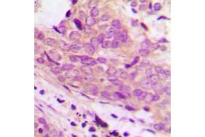 Immunohistochemistry (IHC) image for anti-Membrane-Associated Ring Finger (C3HC4) 1, E3 Ubiquitin Protein Ligase (MARCH1) (Center) antibody (ABIN7301464)