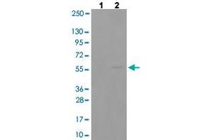 Western blot analysis of Lane 1: antigen-specific peptide treated COLO205 cells, Lane 2: COLO205 cells with SYT1 (phospho T202) polyclonal antibody  at 1:500-1:1000 dilution. (SYT1 Antikörper  (pThr202))
