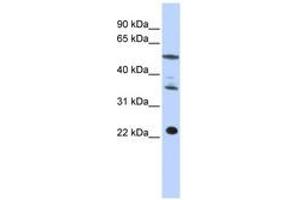 Image no. 1 for anti-Centromere Protein M (CENPM) (C-Term) antibody (ABIN6740964) (CENPM Antikörper  (C-Term))