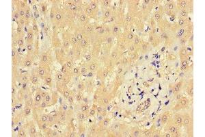 Immunohistochemistry of paraffin-embedded human liver tissue using ABIN7165997 at dilution of 1:100 (BBS9 Antikörper  (AA 8-185))