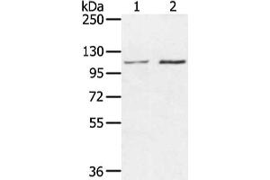 Gel: 6 % SDS-PAGE, Lysate: 40 μg, Lane 1-2: Hepg2 and hela cell, Primary antibody: ABIN7130215(MED16 Antibody) at dilution 1/400 dilution, Secondary antibody: Goat anti rabbit IgG at 1/8000 dilution, Exposure time: 20 seconds (MED16 Antikörper)