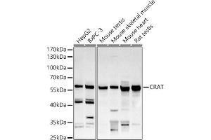 Western blot analysis of extracts of various cell lines, using CRAT antibody (ABIN6131297, ABIN6139003, ABIN6139004 and ABIN6221982) at 1:500 dilution. (CRAT Antikörper  (AA 357-626))