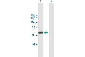 Western Blot analysis of TRIM45 expression in transfected 293T cell line by TRIM45 MaxPab polyclonal antibody. (TRIM45 Antikörper  (AA 1-562))