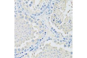 Immunohistochemistry of paraffin-embedded mouse testis using SLC2A9 antibody (ABIN6291466) at dilution of 1:100 (40x lens). (SLC2A9 Antikörper)