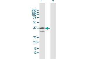 Western Blot analysis of ANXA1 expression in transfected 293T cell line by ANXA1 MaxPab polyclonal antibody. (Annexin a1 Antikörper  (AA 1-346))