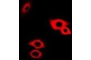 Immunofluorescent analysis of Alpha-galactosidase A staining in Hela cells.