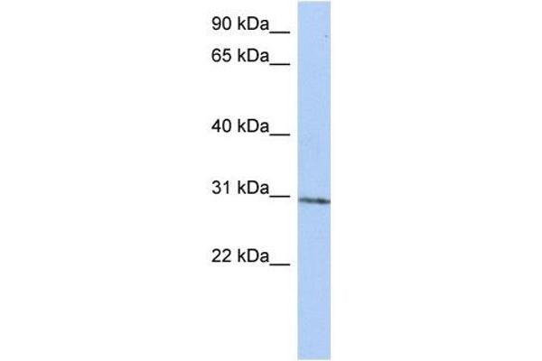 TRMT61A Antikörper  (N-Term)