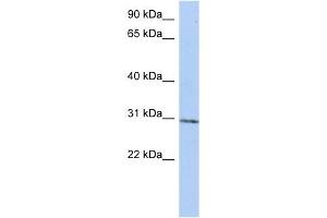 C14ORF172 antibody used at 1 ug/ml to detect target protein. (TRMT61A Antikörper  (N-Term))