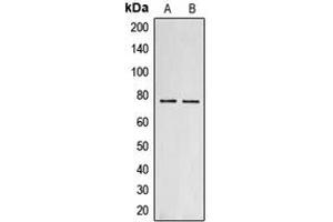 Western blot analysis of Collagen 18 alpha 1 expression in MCF7 (A), PC12 (B) whole cell lysates.