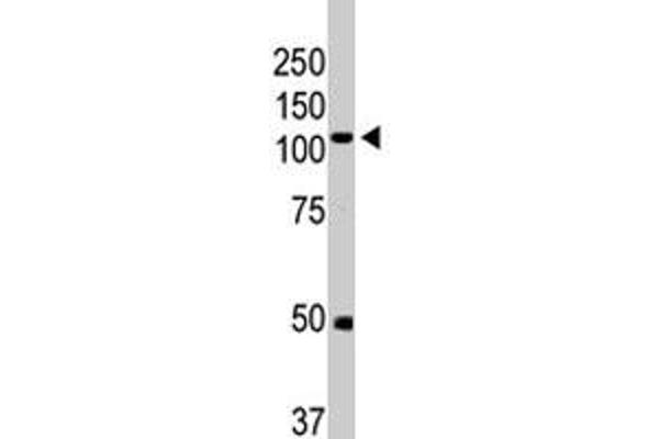 BMPR2 Antikörper  (AA 28-59)