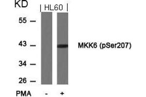 Western blot analysis of extracts from HL60 cells untreated or treated with PMA using MKK6(Phospho-Ser207) Antibody. (MAP2K6 Antikörper  (pSer207))