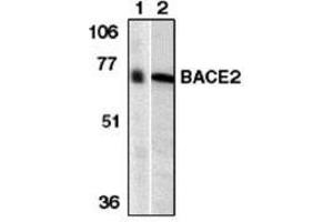 Image no. 1 for anti-beta-Site APP-Cleaving Enzyme 2 (BACE2) (AA 44-59) antibody (ABIN264996) (BACE2 Antikörper  (AA 44-59))