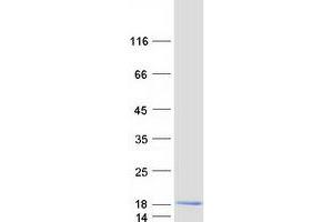Western Blotting (WB) image for Chromosome 12 Open Reading Frame 57 (C12orf57) protein (Myc-DYKDDDDK Tag) (ABIN2729776)