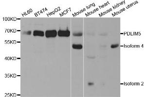 Western blot analysis of extracts of various cell lines, using PDLIM5 antibody (ABIN5973350) at 1/1000 dilution. (PDLIM5 Antikörper)
