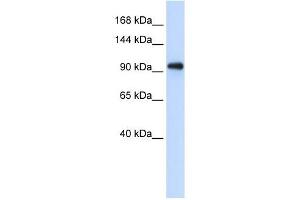 EXOSC10 antibody used at 1 ug/ml to detect target protein.