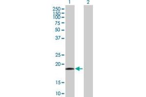 Western Blot analysis of DR1 expression in transfected 293T cell line by DR1 MaxPab polyclonal antibody. (DR1 Antikörper  (AA 1-176))