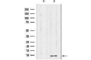 anti-Thymosin beta-4 (TMSB4X) (N-Term) antibody